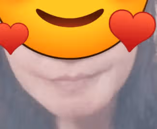 슈링크 첫 후기. 성공적.