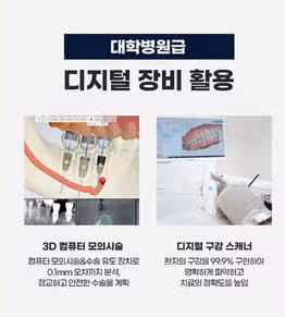 임플란트 수술 아프진 않나요? 걱정태산