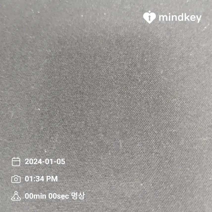 조증과 울증의 반복 조울증
