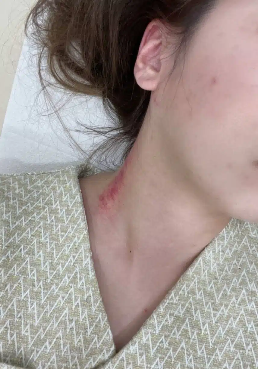 안면비대칭교정 한의원에서 효과봣어요