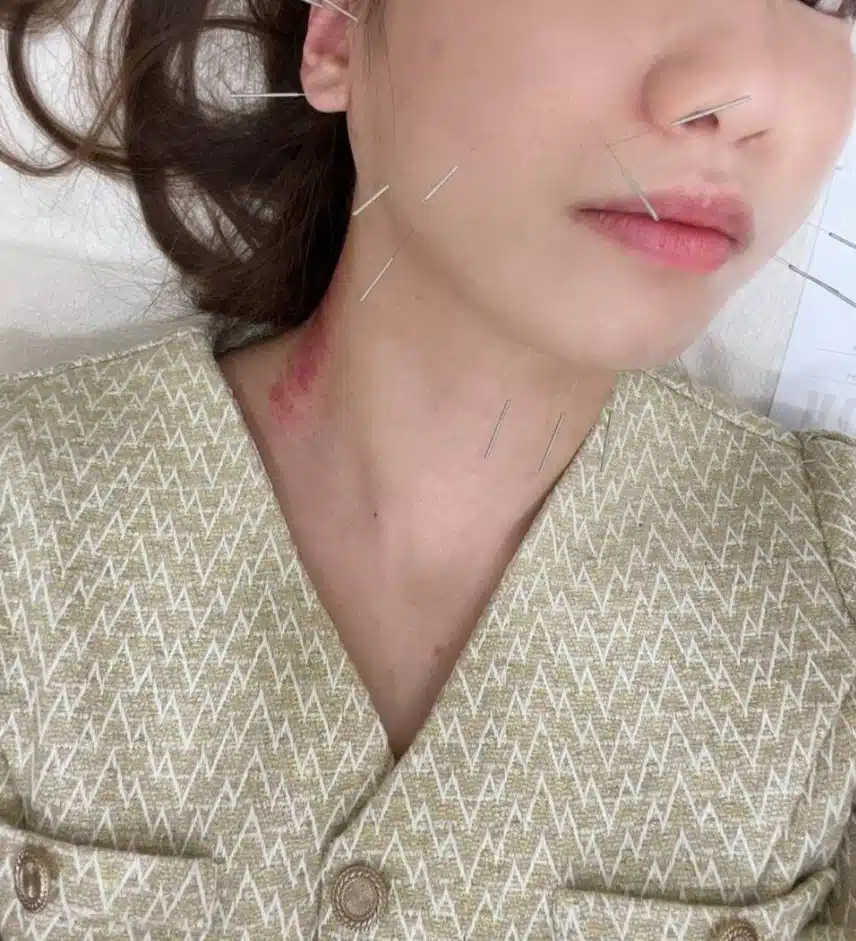 안면비대칭교정 한의원에서 효과봣어요