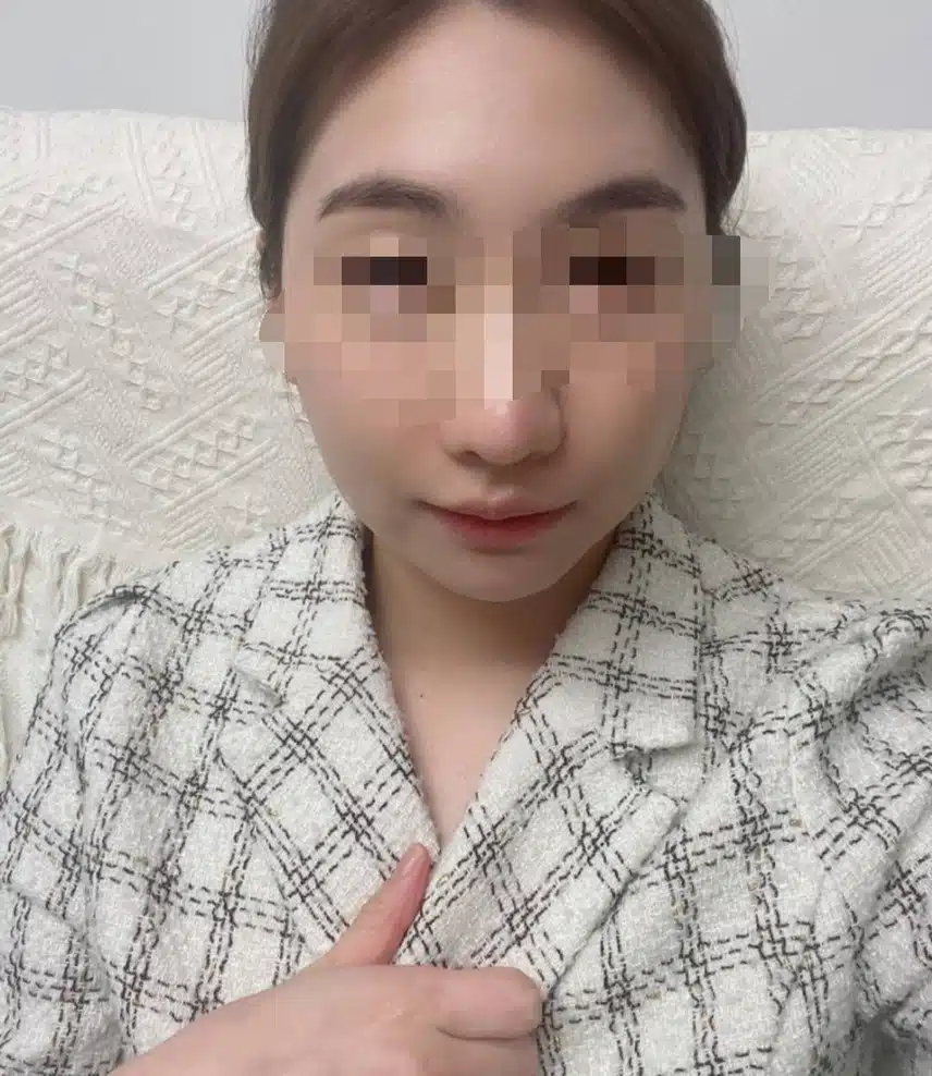 안면비대칭교정 한의원에서 효과봣어요