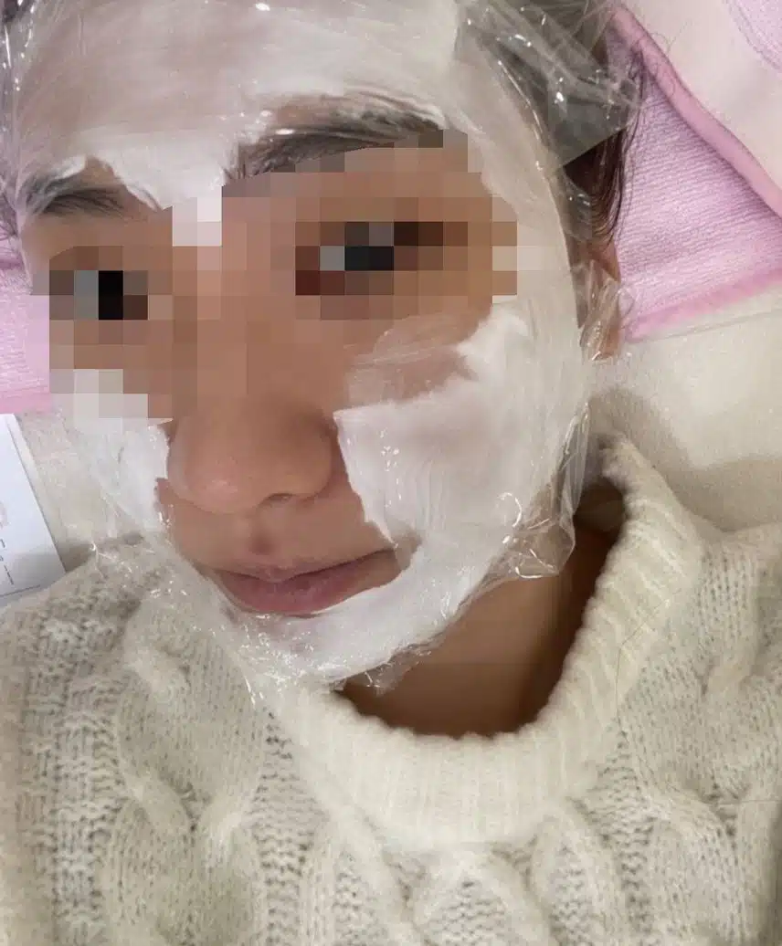 안면비대칭교정 한의원에서 효과봣어요