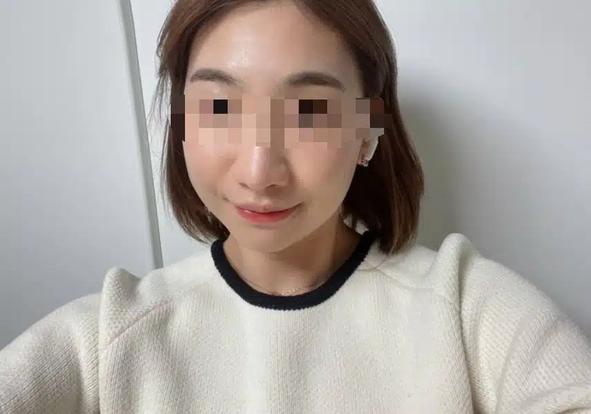 안면비대칭교정 한의원에서 효과봣어요