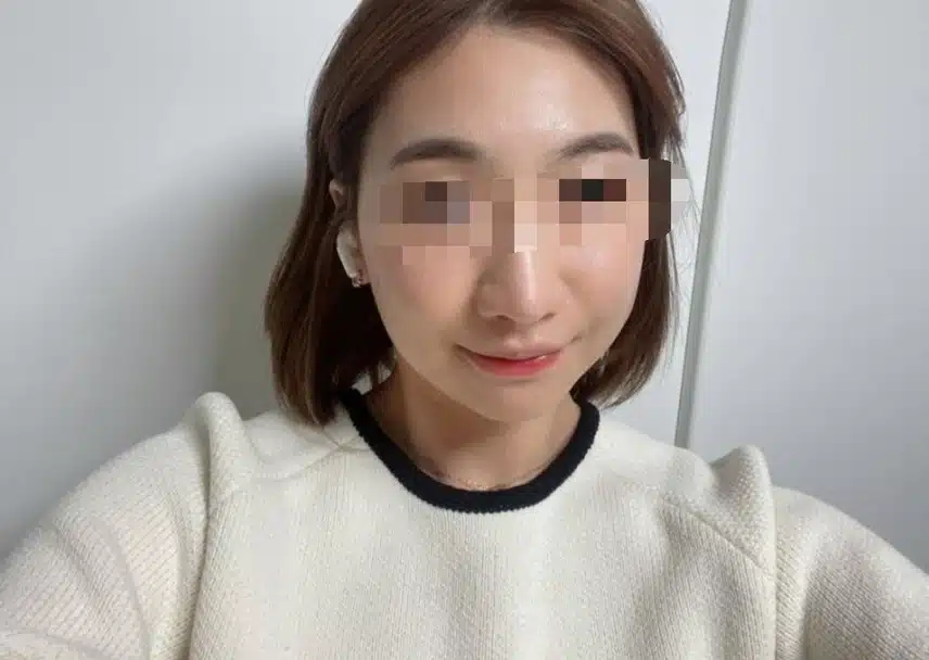 안면비대칭교정 한의원에서 효과봣어요