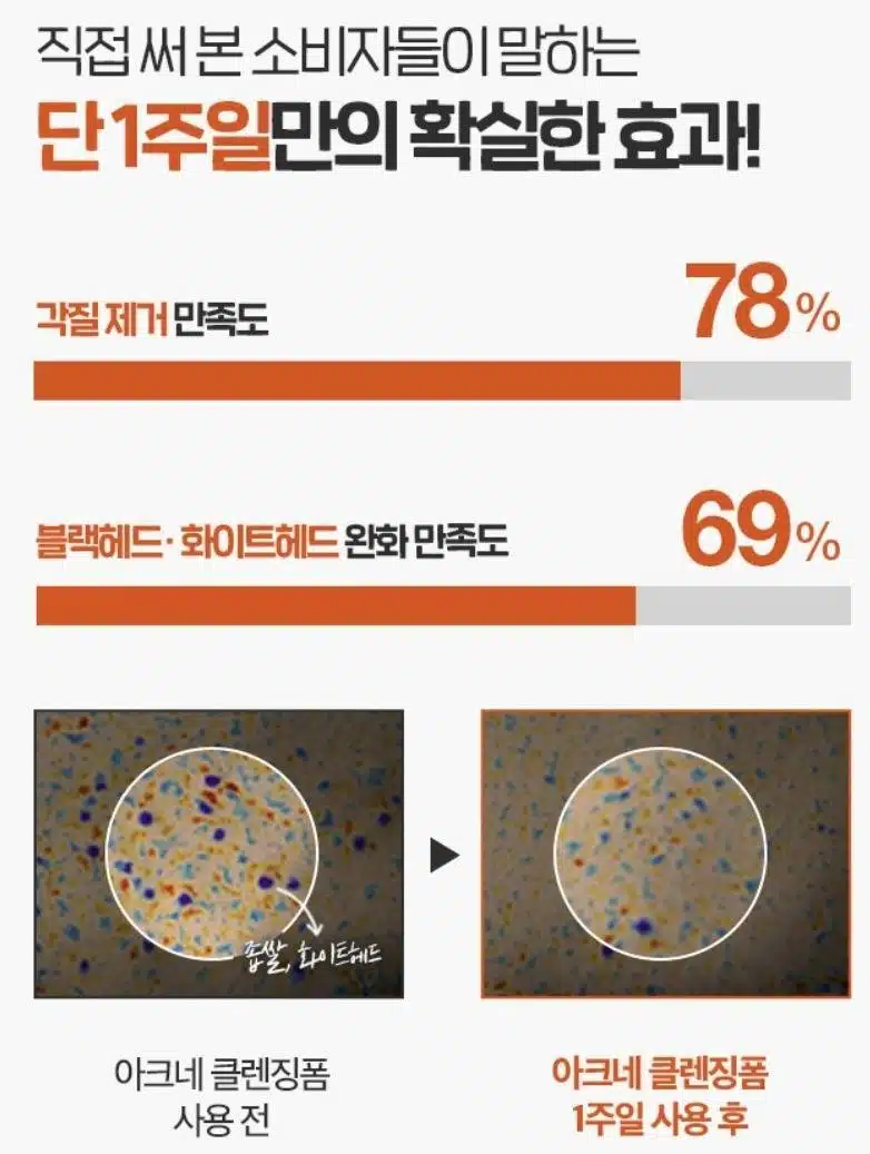 뉴트로지나 폼클레징 추천합니다 