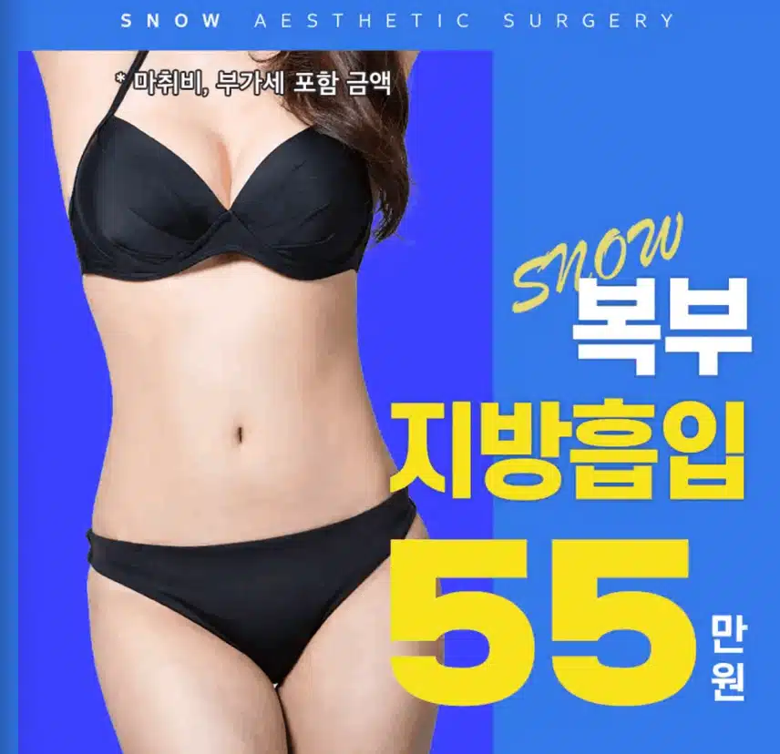 지방흡입 가격 비싸지 않네요~ 생각보다 저렴한 거 같아요