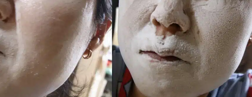 어성초가 들어가 여드름에 좋은 더블 클린 시스템 클렌징