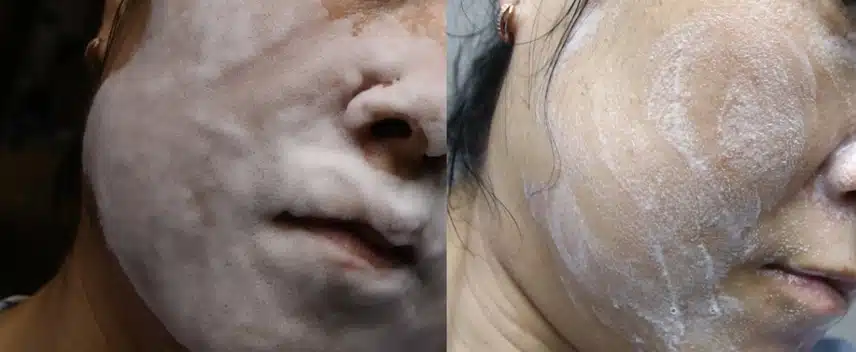 어성초가 들어가 여드름에 좋은 더블 클린 시스템 클렌징