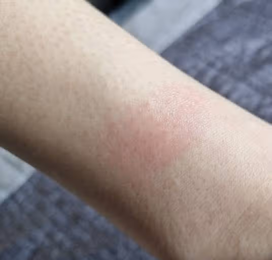 아티스트 하이드라블룸 내돈내산