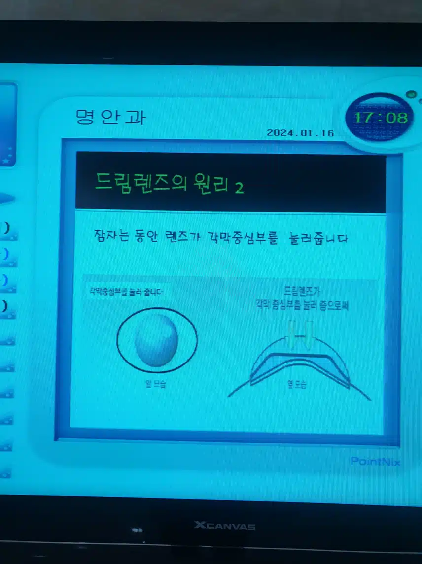 드림렌즈 효과가 있을까요?