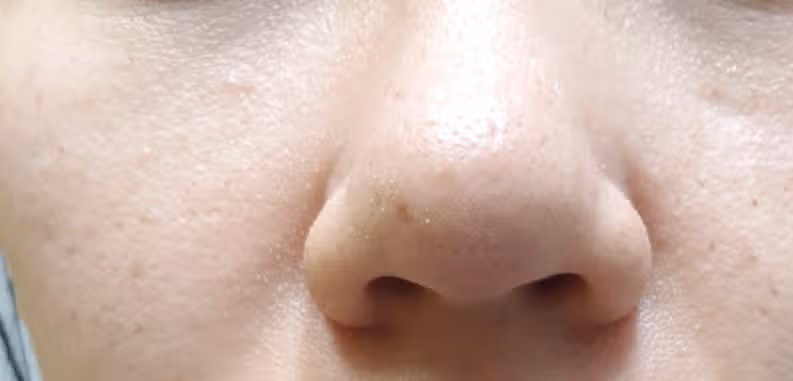 [7/1주 키워드] 클렌징제폼🫧🧼