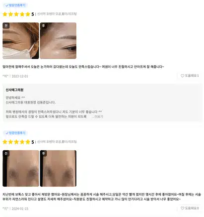 여드름흉터는 시술을 받아야 없어지겠죠...?
