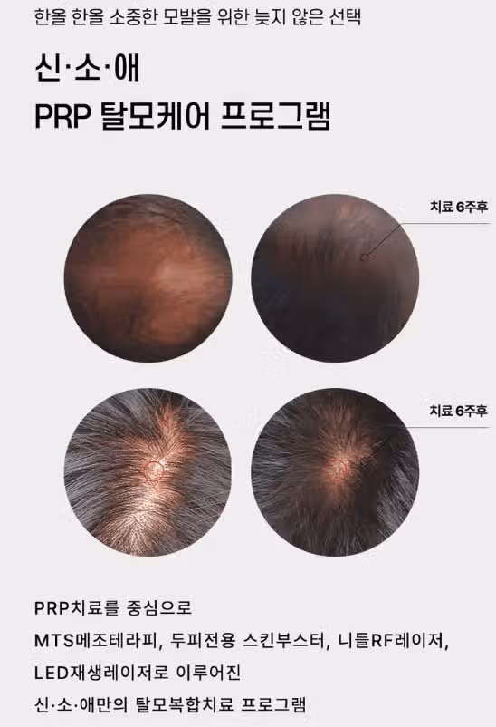 m자 탈모 병원 여기 어떨까요? 