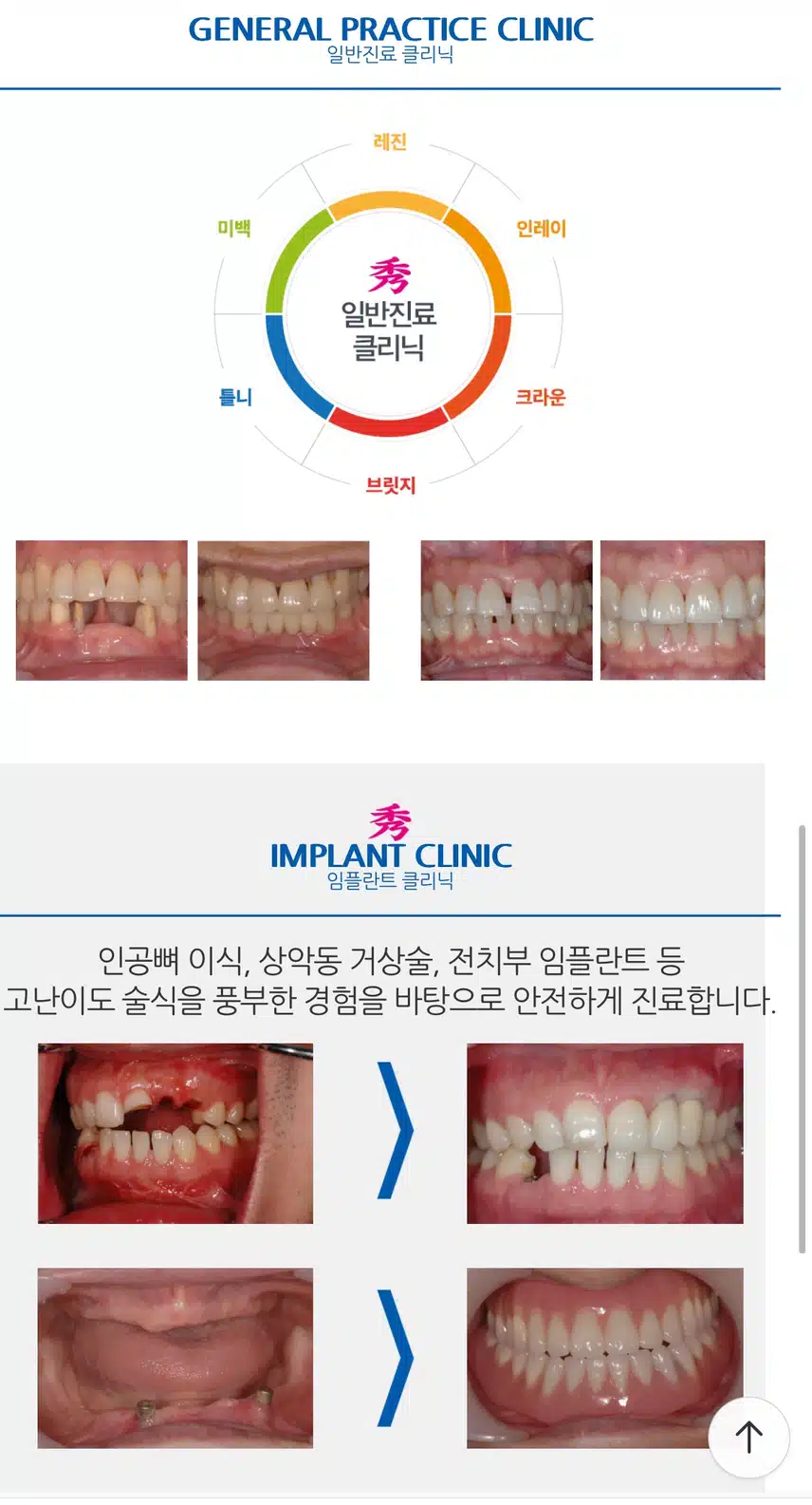 정성가득수치과 추천합니다.