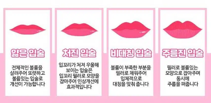 입꼬리 필러&보톡스시술 받고싶어요!
