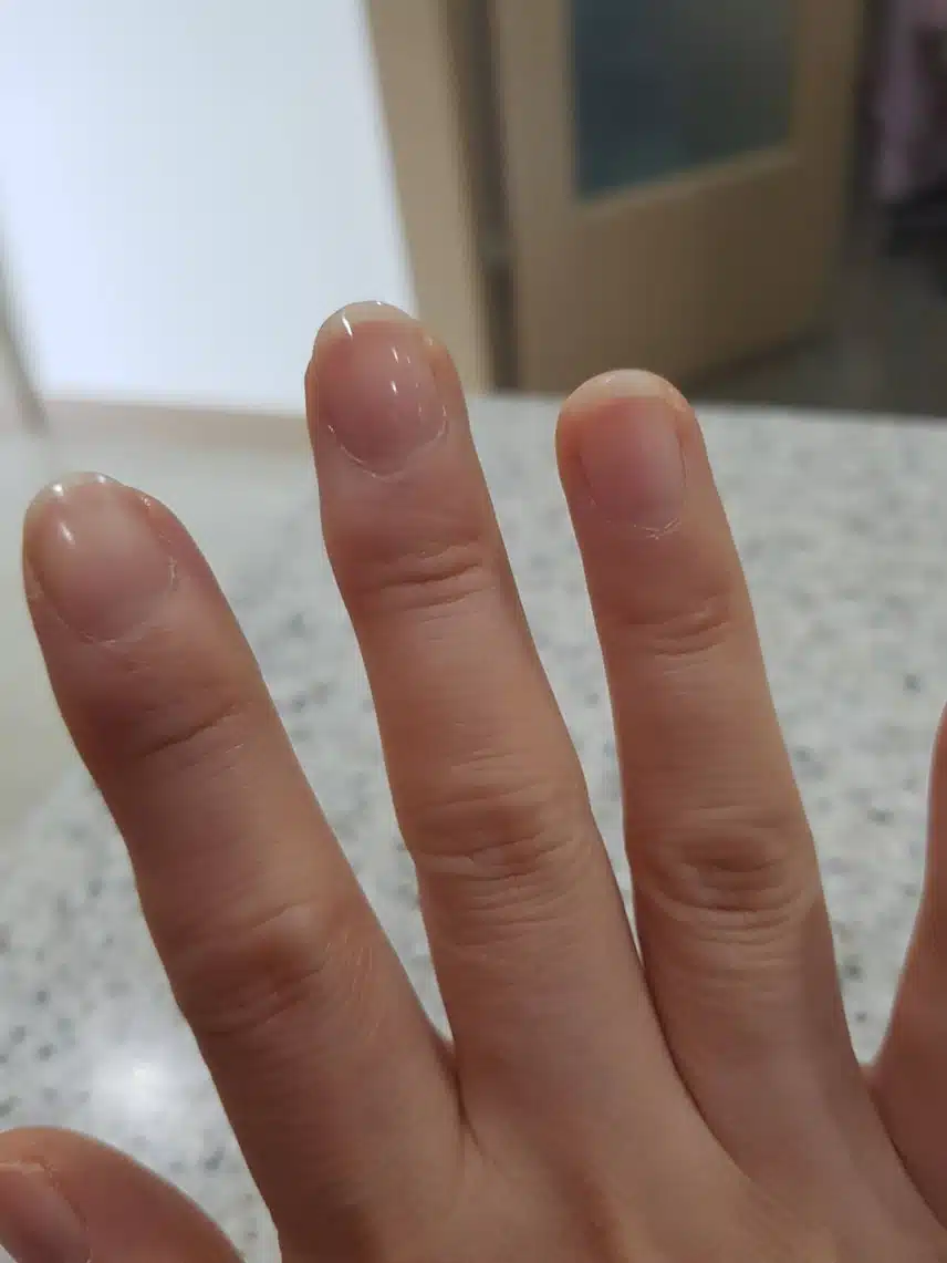 수운수 손톱영양제세트 소개합니다 