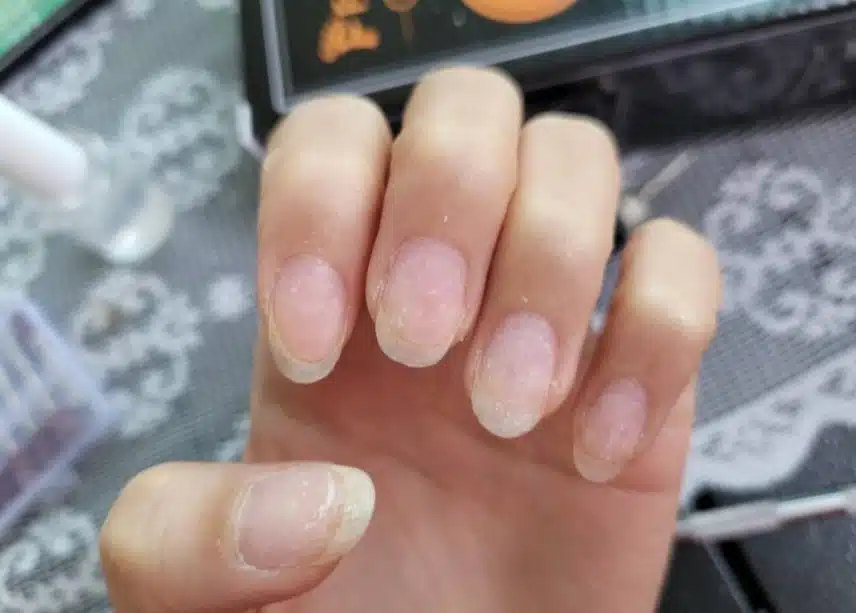 집에서 혼자 손쉽게 큐티클제거하고 영양제까지 관리하자