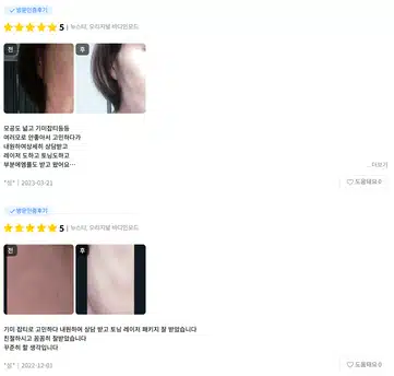 바디인모드 군살 정리에 추천인가요?