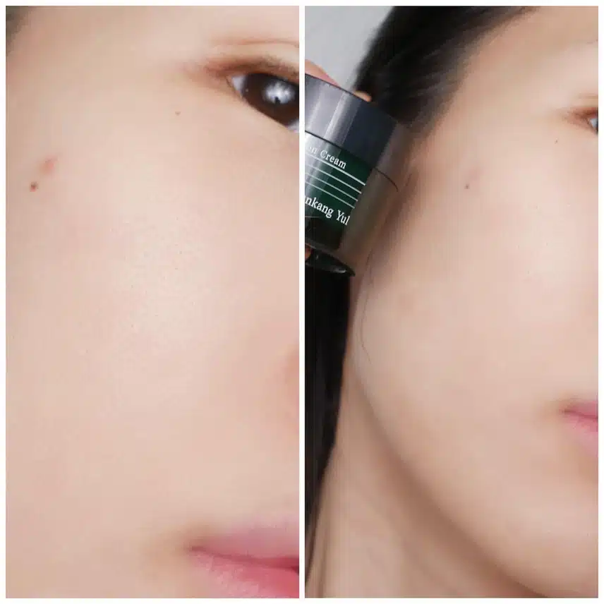 트러블 날 때 진정 기초 라인 편강율 얼티밋 추천해요!