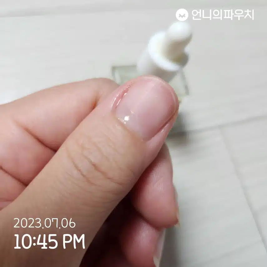 건조하고 일어나는 손톱에 큐티클관리오일