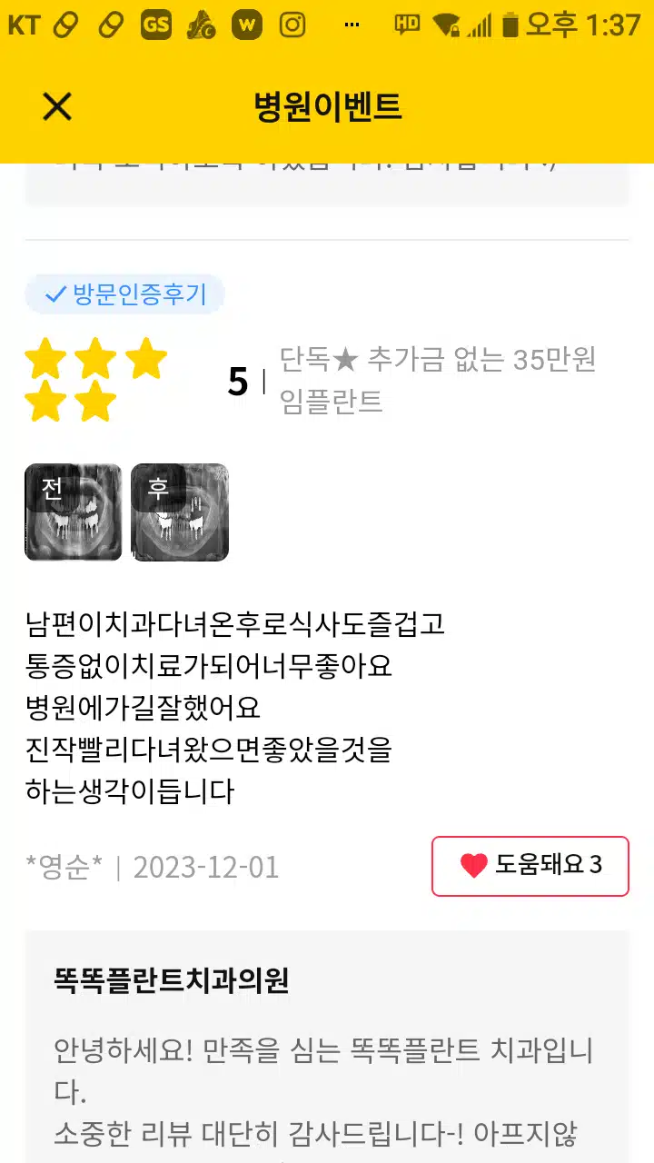 똑똑플란트치과의원 임플란트 후기 추천합니다