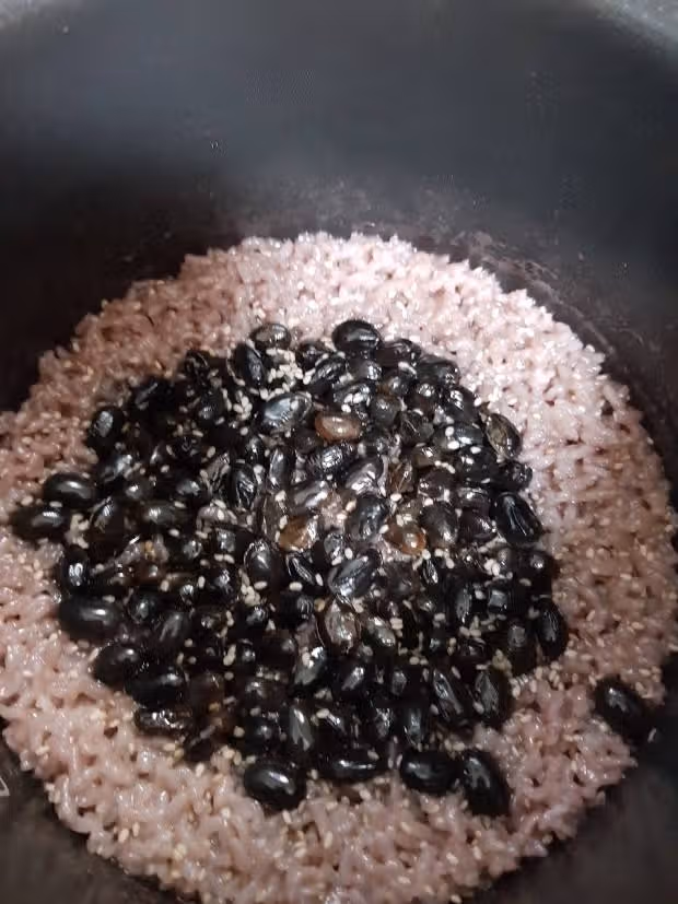 건강꿀팁) 저에 산후탈모 관리방법요
