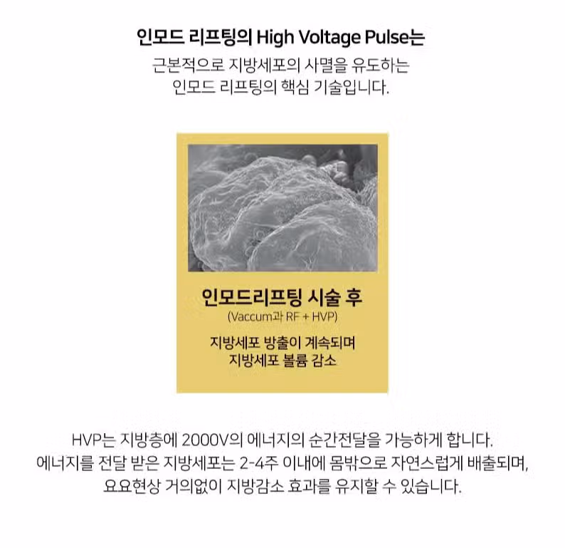 홍대인모드 정보 알고싶어요. 어떤 효과가 있는건가요? 