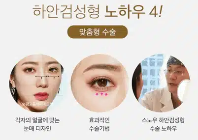 상안검 하안검 상담 받고 싶어요!!!