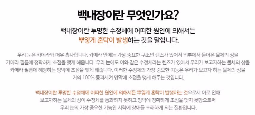백내장 수술로 유명한 세란안과~ 추천해요~ 