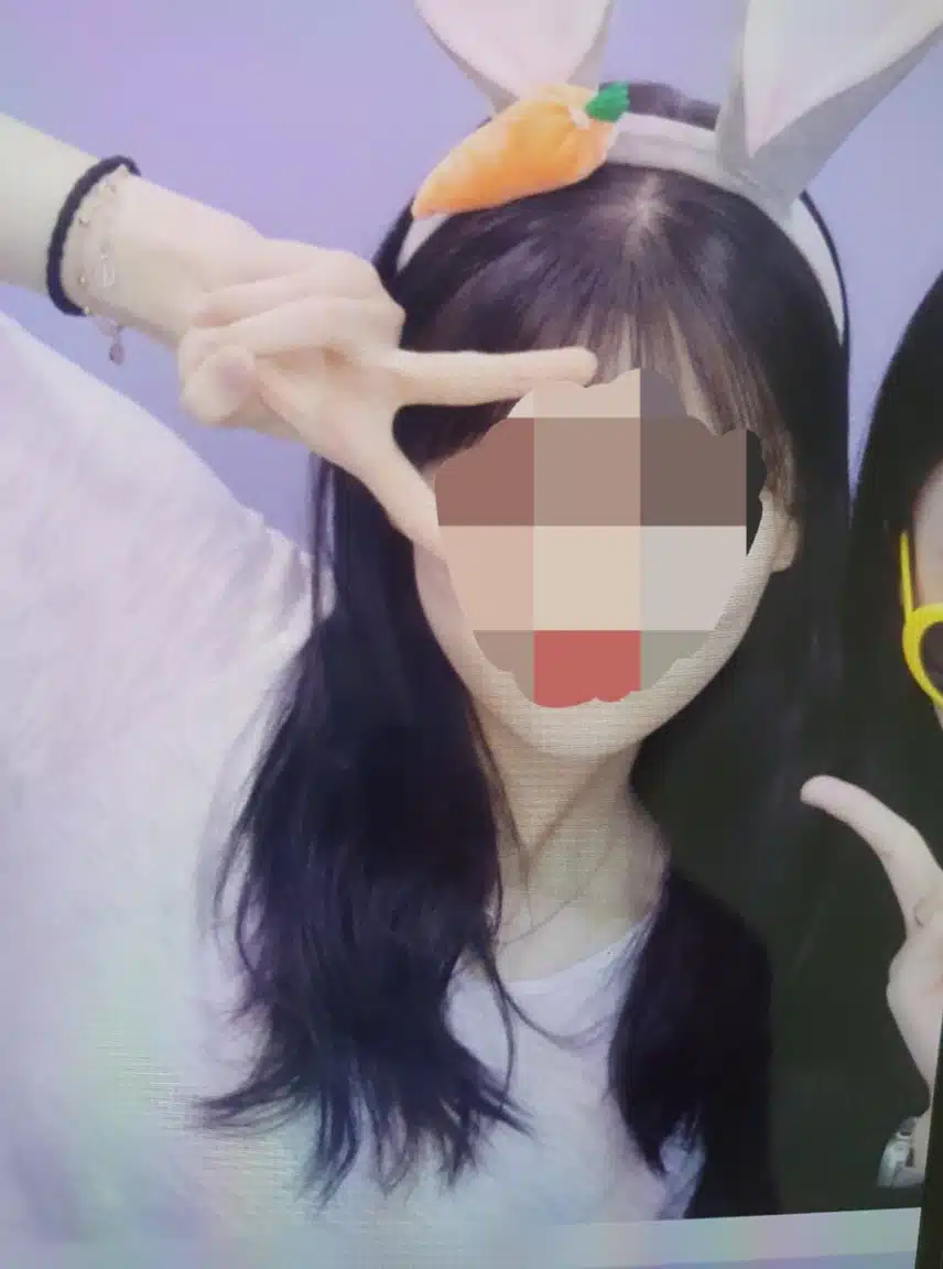 [탑리뷰어 5기] 브이컷주사 후기 ✌🏻