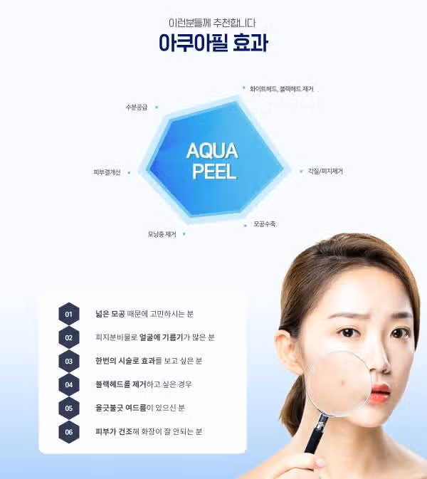 아쿠아필 받아보고싶어요