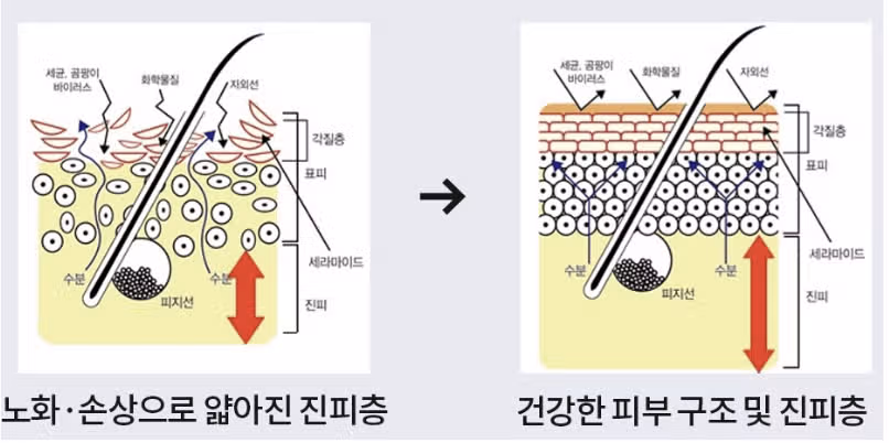 받고 싶은 시술 - 리쥬란아이 편
