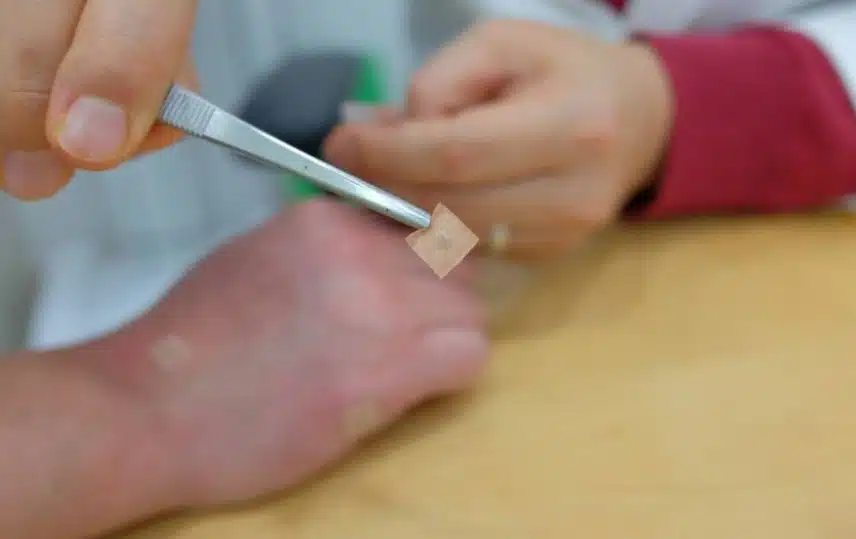 한의원 비염수술없이 치료한 후기