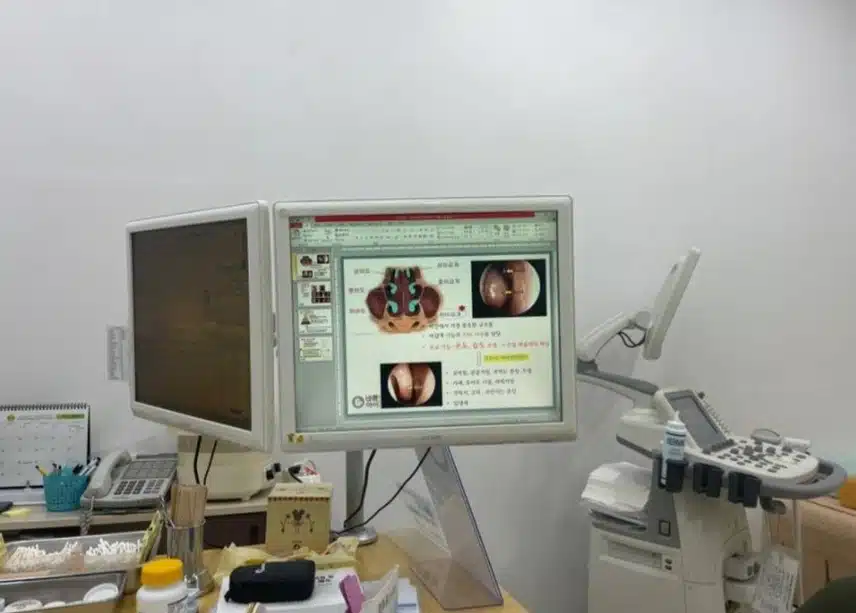 한의원 비염수술없이 치료한 후기