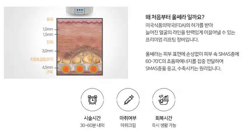 울쎄라로 이중턱 고민 해결하고 싶네요~ 