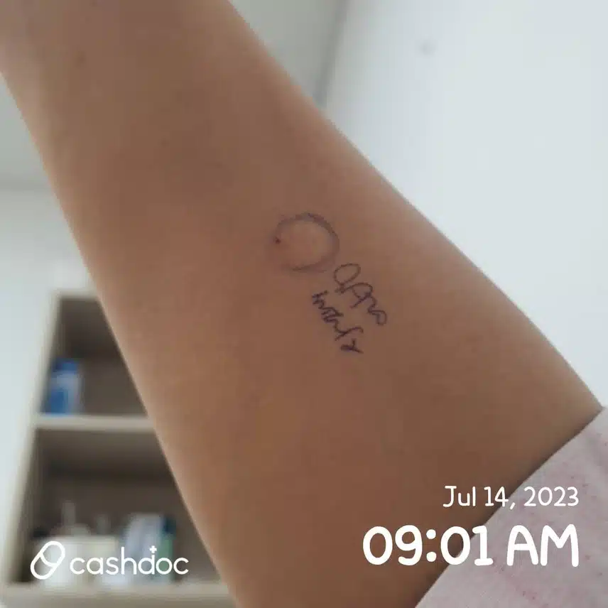 맘스여성병원에서 자궁용종 제거한 후기