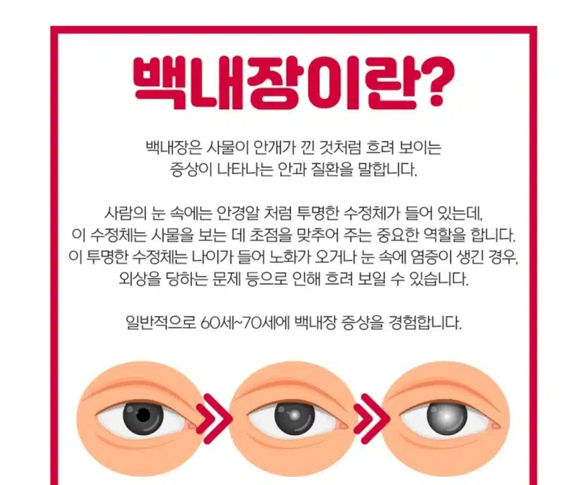 백내장 수술전문안과 - 대전 유성구 서울안과 