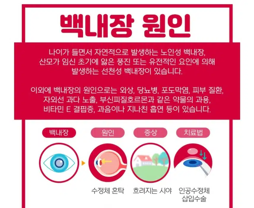 백내장 수술전문안과 - 대전 유성구 서울안과 