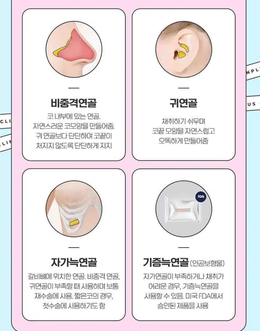 매부리코수술 후기 알려드립니당. (2곳)
