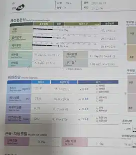 꼭대기을 찍고 시작한 장거리 다이어트 후기 (못볼꼴 주의)
