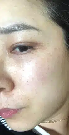 친절하고 상담잘해주셔서 믿고 방문할 수 있는 이수역 라마르 피부과 입니다. 