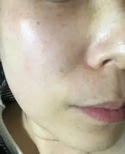 친절하고 상담잘해주셔서 믿고 방문할 수 있는 이수역 라마르 피부과 입니다. 