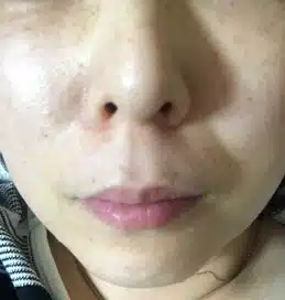 친절하고 상담잘해주셔서 믿고 방문할 수 있는 이수역 라마르 피부과 입니다. 