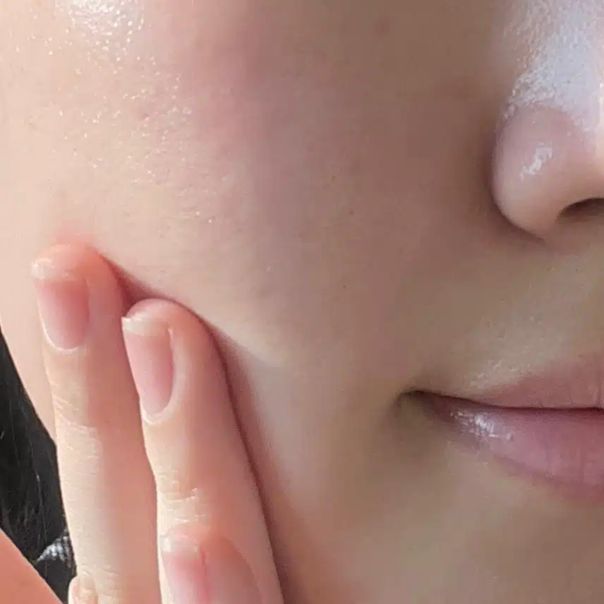 에스트라365크림에 가려진 찐템