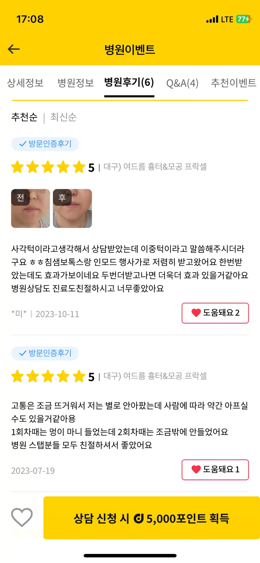 유앤아이의원 대구점에서 프락셀 후기 비교 해봤어요!