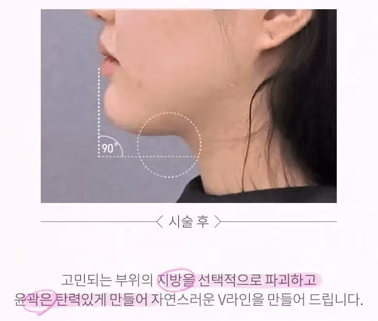 안양인모드를 찾는데 ㅠㅠ 경기도, 서울 다 궁금해요!! 