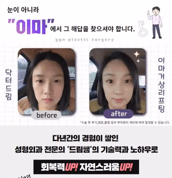 이마거상 후기 궁금한사람?? 정보를 알려드릴게요~! 