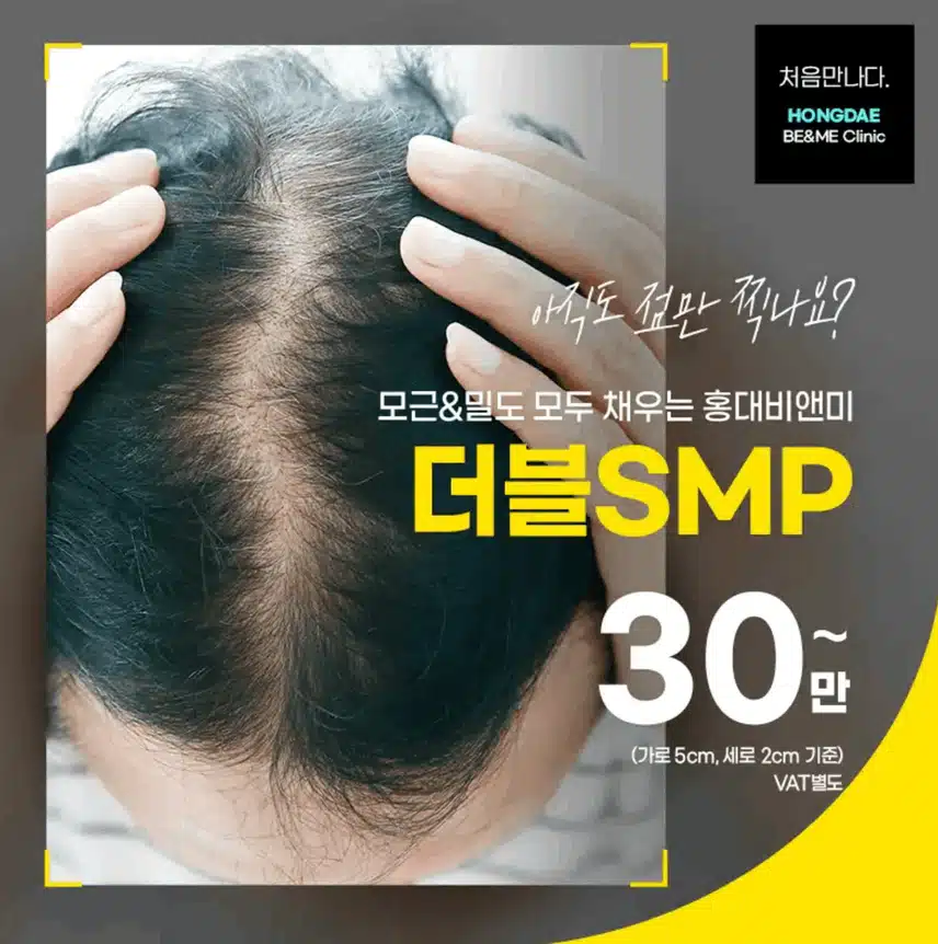 두피타투 있는 거 다들 아세요?? 완전 신기해보여서 알아보고 있어요~!