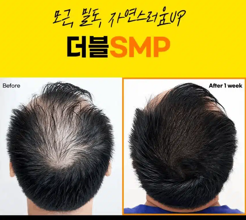 두피타투 있는 거 다들 아세요?? 완전 신기해보여서 알아보고 있어요~!